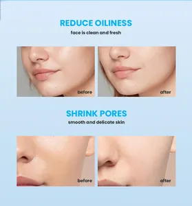 Before and after skin results showing oil control and pore reduction with facial cleanser