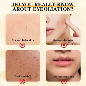 Gráfico detallado de problemas de piel como sequedad y opacidad para suero exfoliante