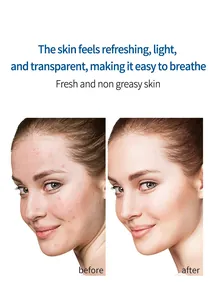 Comparaison visuelle de la lotion de protection pour une peau fraîche, nette et non grasse