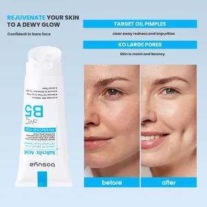 bosuya Vitamin B5 Salicylic Acid Oil Control Facial Cleanser with before after skin result