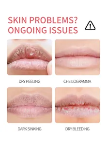 Detaillierte Ansicht häufiger Lippenprobleme wie Schälen, Linien, Dunkelheit und Bluten.