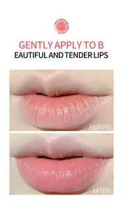Detaillierter Makro-Vorher-Nachher-Vergleich der Ergebnisse der Lippenmasken-Kur
