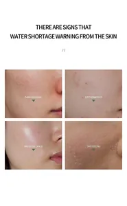 Detail view showing various skin concerns including dryness and redness for collagen toner.