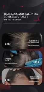 Infografica su problemi di caduta capelli come stempiatura e diradamento dei capelli
