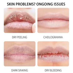 Close-up detail view showing various lip skin issues like dryness, peeling, and cracks.