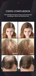Shampoo per crescita capelli prima e dopo con risultati di densità visibili