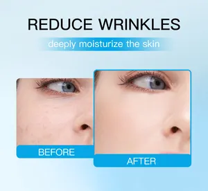 Facial skin comparison showing before and after results of anti-wrinkle moisturizing cream