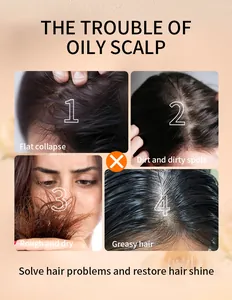 Infographic over vette hoofdhuid en droog haar problemen voor haarsampoo-uitleg.