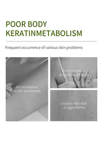 Detalle que muestra problemas de la piel como acumulación de suciedad para gel corporal.