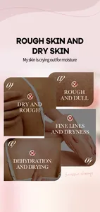 Infographic over droge, ruwe en gedehydrateerde huid voor behandeling met bodylotion.