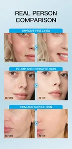 Before and after results of FORMBO moisturizing face cream for plump and hydrated skin