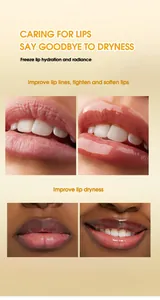 Before and after comparison showing deep lip hydration and improvement of lip lines.