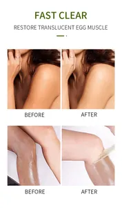 Comparación detallada antes y después del efecto del gel peeling en rodilla y hombro