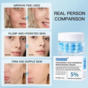 FORMBO 5% Hyaluronic Acid Intensive Moisturizing Cream with before-after skin comparison