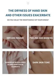 Detail showing dry, peeling, and dark hand skin issues addressed by cream.