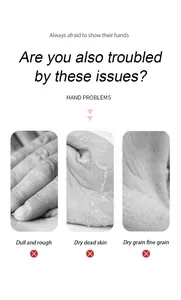 Close-up detail showing dry and rough hand skin issues addressed by hand cream.