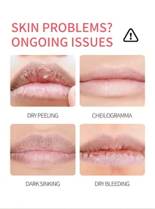 Detalle de afecciones labiales: descamación seca, manchas oscuras y sangrado leve.