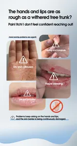 Detail view showing dry skin and cracked lips issues for repairing cream treatment