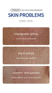 Detailed view of common skin problems like dryness, redness, and pores for face cream