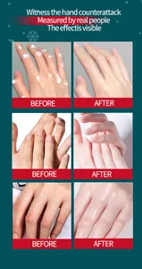 Detailed view of before and after hand cream results showing visible moisturizing skin effects