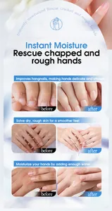 Detailed before and after comparison showing hydrating effects of hand cream set