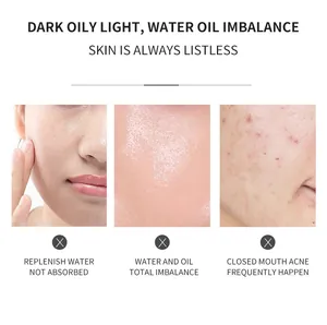 Detailed view of skin issues like oiliness and acne for collagen moisturizing face serum