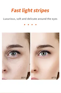 Before and after comparison of Vitamin C eye cream reducing fine lines around eyes