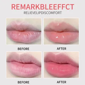 Set de mascarillas labiales ADMD hidratantes con efecto antes y después para labios