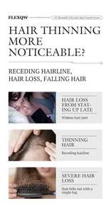 Vue détaillée expliquant les causes de la chute des cheveux comme le manque de sommeil