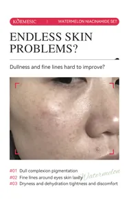 Detailed view of facial skin texture highlighting dullness and fine lines for skincare