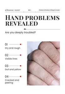 Nahaufnahme von trockener rissiger Haut für Handcreme-Detailseite