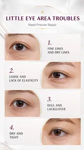 Close-up of common eye area skin concerns demonstrating retinol serum repair efficacy