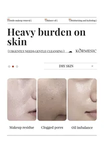 Nahaufnahme von Hautproblemen wie verstopften Poren für KORMESIC Makeup-Entferner