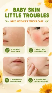 Infographic showing baby skin issues like dryness, redness, and peeling.