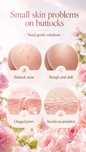 Visual guide to common buttock skin concerns treated by KORMESIC body scrub