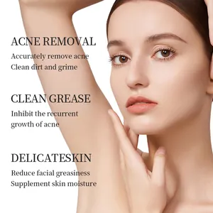 Detail view showing smooth skin results for Kormesic azelaic acid acne face cream.