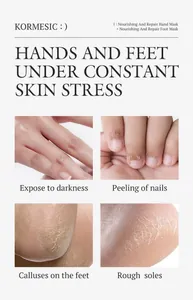Detailed view of hand and foot skin issues treated by KORMESIC nourishing masks
