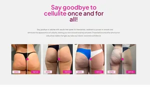Detailed before and after results of anti-cellulite heat cream for smooth skin