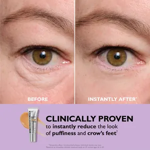 Vorher-Nachher-Vergleich der Anti-Aging-Augencreme gegen Falten.
