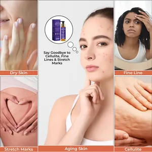 Huile corporelle de luxe pour le traitement des vergetures, de la cellulite et de l'âge.