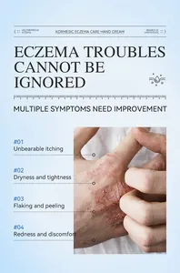 Gros plan sur les symptômes de l'eczéma et efficacité de la crème mains KORMESIC
