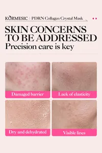 Vue macro des problèmes de peau comme la déshydratation résolus par le masque au collagène