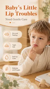 Educational infographic illustrating common baby lip issues such as dry and peeling lips