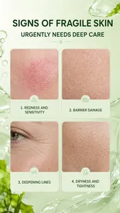 Vue détaillée de quatre problèmes de peau comme les rougeurs traités par ce masque