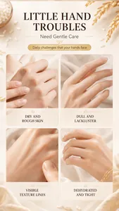 Detailed close-ups showing dry and dehydrated hand skin conditions for rice cream