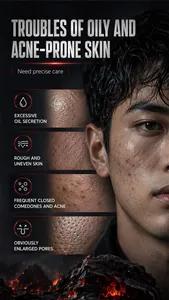 Detalles visuales de problemas de la piel para el limpiador facial de barro volcánico KORMESIC
