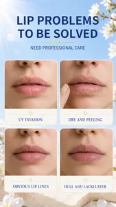 Infographic detail showing lip dryness, peeling and lines solved by moisturizing lip balm care
