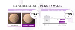 Detail showing 4-week skin volume and barrier clinical results for PDRN cream