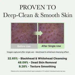 Confronto macro prima e dopo la pulizia profonda dei pori con Green Rice Cleanser