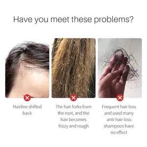 Close-up showing common hair problems like thinning hairline and frizzy texture details